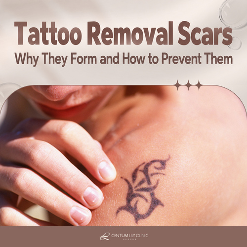 Why Do Scars Form After Tattoo Removal?