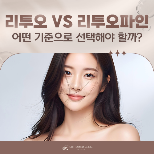 리투오와 리투오파인, 어떤 기준으로 골라야 할까?