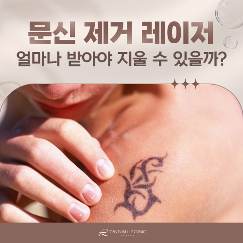 문신 제거 후 흉터가 남는 이유는 무엇일까?