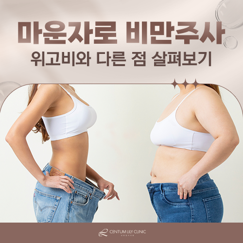 마운자로와 위고비는 무엇이 다른가요?
