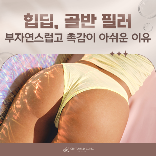 힙딥 골반필러, 가격보다 먼저 봐야 할 것은?